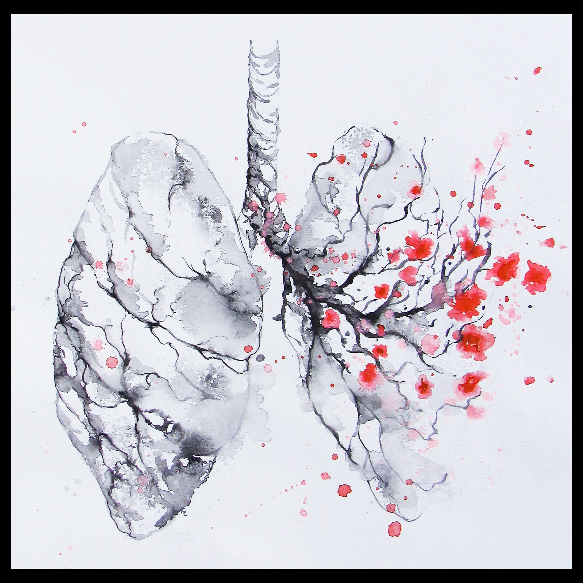 Abstract Watercolor Painting Human Lungs and Cherry Etsy