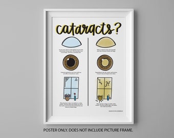 Cataract Poster | Cataract Educational Poster | Optometry Wall Decor