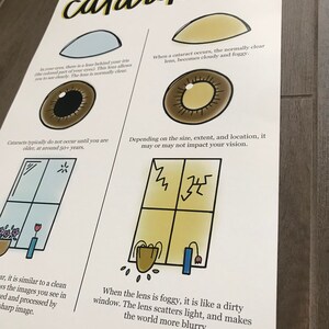 Cataract Educational Poster: Optometry Office Wall Decor - Etsy