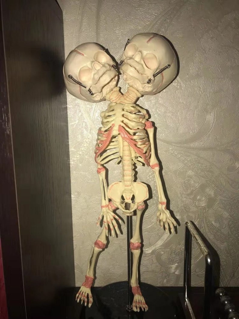 Tibetan Craft Human New Born Double Head Baby Anatomy Skull Etsy