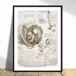 Studies of the Foetus in the Womb - Leonardo da Vinci | Anatomy Illustration, Reproduction Print, Renaissance Decor, Vintage Anatomy Poster