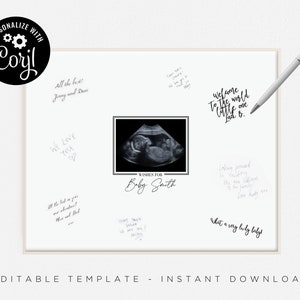 Baby Shower Ultrasound Guest Print Template Instant Download Using Corjl Editable File