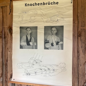 Schulwandkarte Wandkarte Knochenbrüche rar Deutsches Hygienemuseum Dresden