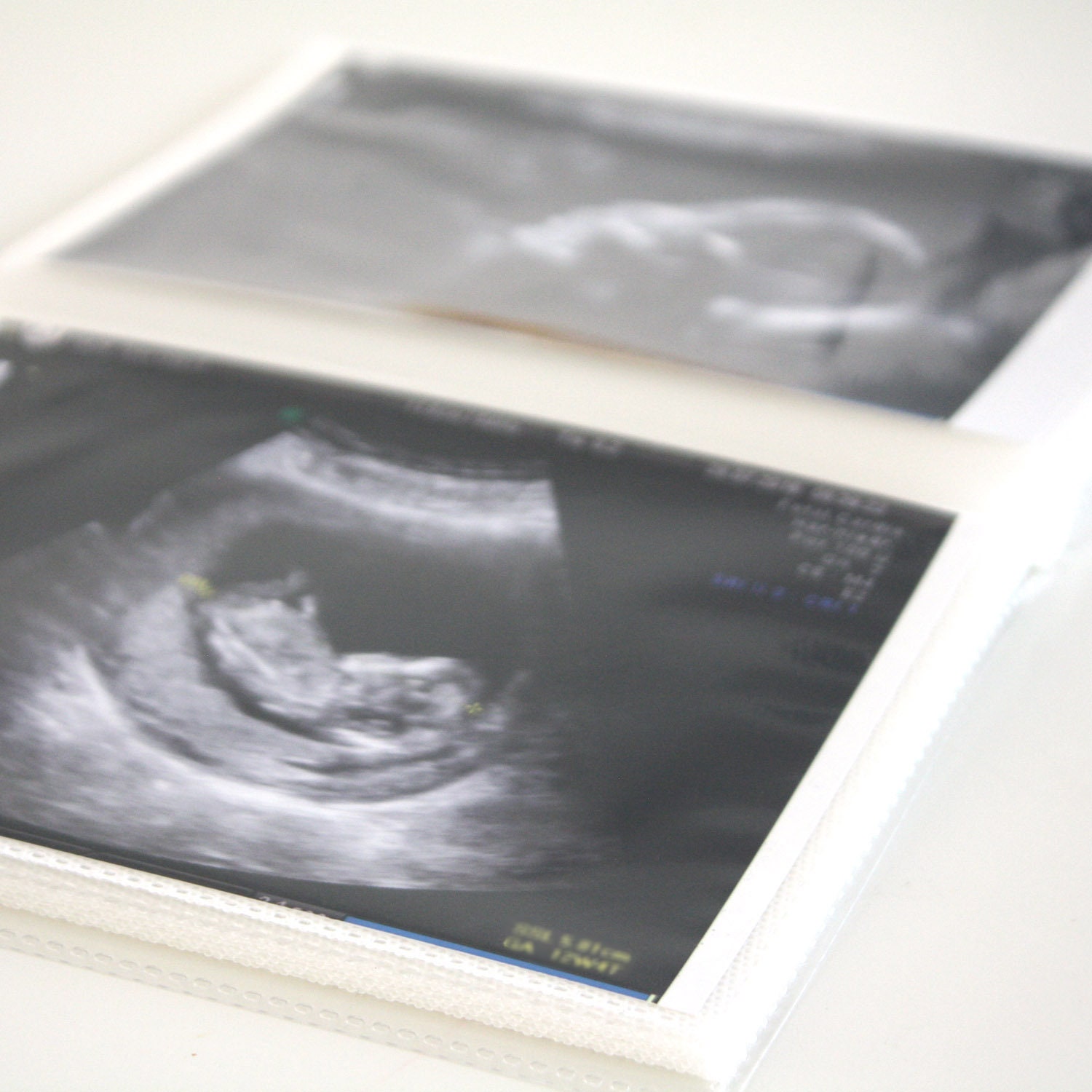 Ultraschallbilder Album Personalisierbar - Schwangerschaftserinnerungen