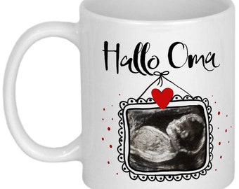 Überraschung Schwangerschaft verkünden Ultraschallbild werdende Oma Geschenk Fototasse Tasse personalisiert Sonogram