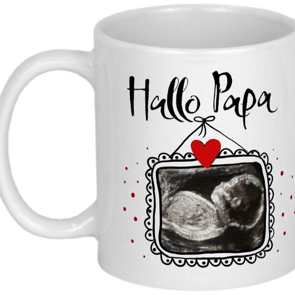 Überraschung Schwangerschaft verkünden Ultraschallbild werdender Papa Geschenk Fototasse Tasse personalisiert Sonogram