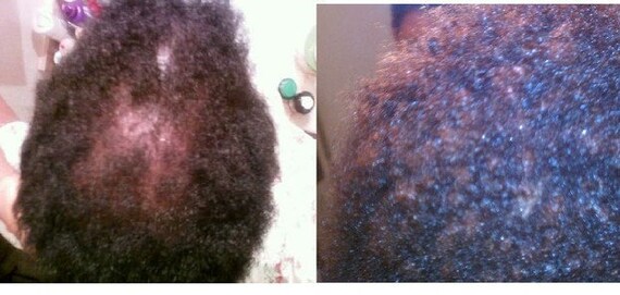 Hair Growth Oil 100 Natural Hair Regrowth Serum Etsy
