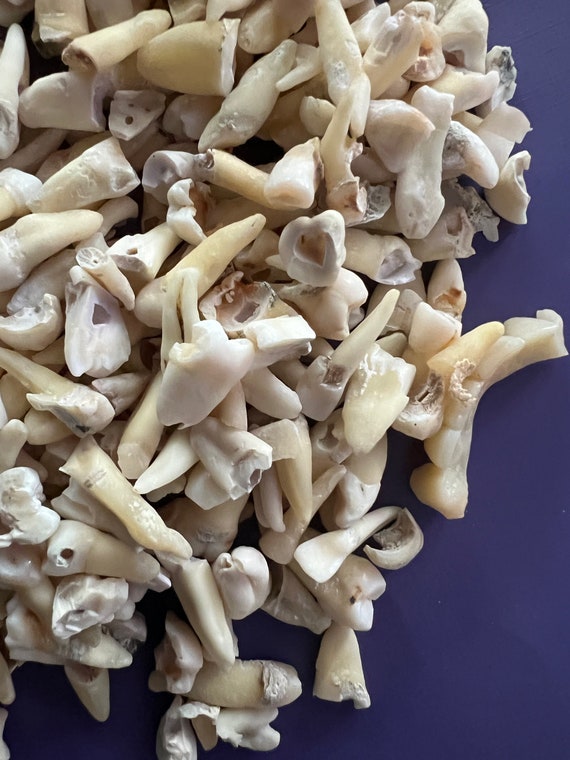 REAL Human Teeth