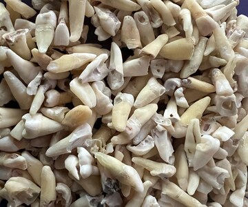 REAL Human Teeth