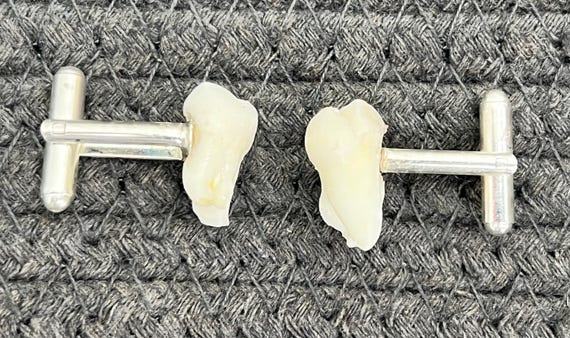 Human Teeth Cuff Links - Meyer Wolfsheim's Cuff Links - the Great