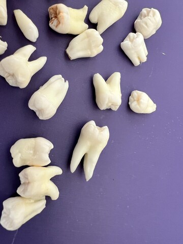 Lot of 20 Real Human Teeth