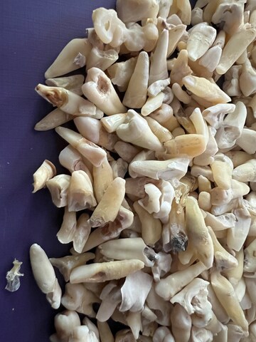 REAL Human Teeth