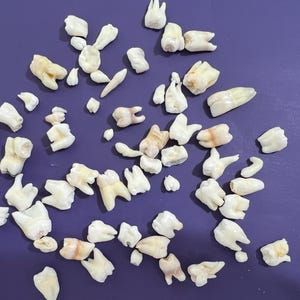 ABNORMAL REAL Human Teeth