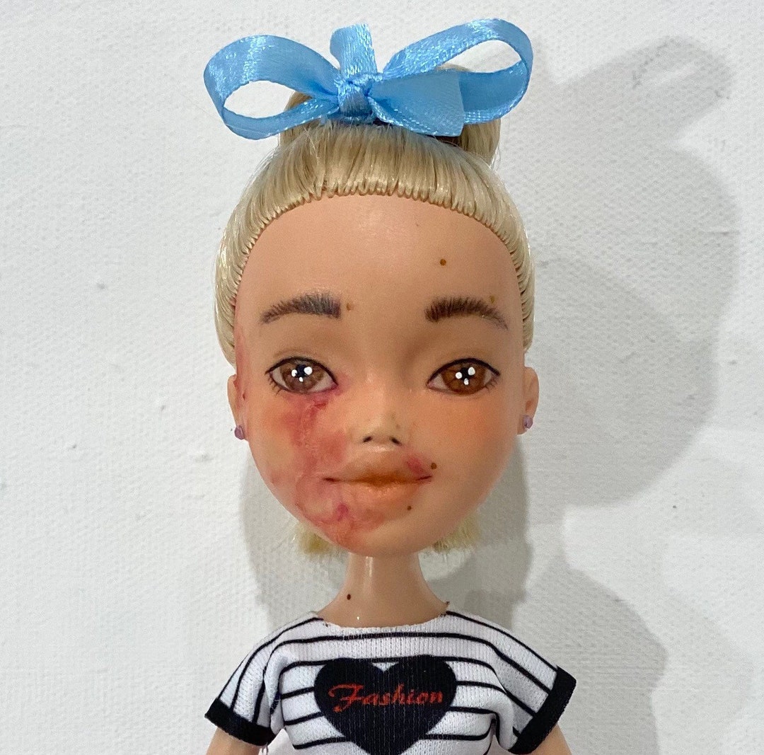 Burn Scar Doll - Etsy