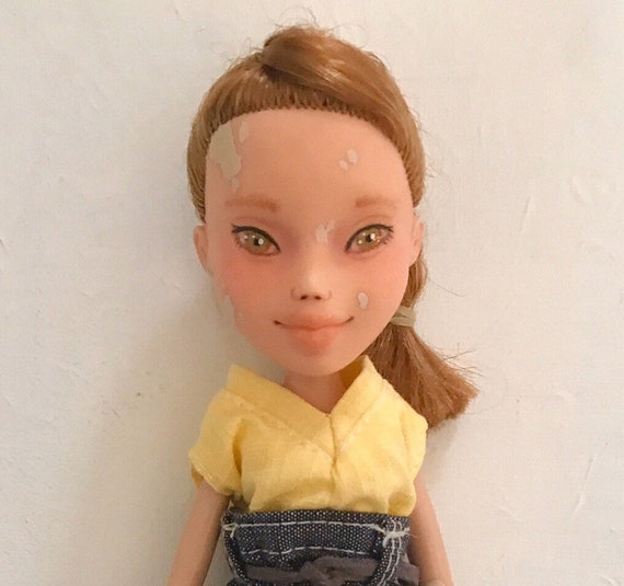 vitiligo bratz doll