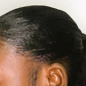 インスタントエッジヘアライン、脱毛症、太めのヘアライン、抜け毛・薄毛対策ユニット、ベビーヘア、ポニーテールにも最適！（フルユニット）