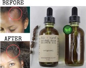 Herbal Hair Growth Oil 4oz - castor oil, pumpkin seed oil, peppermint oil, MSM