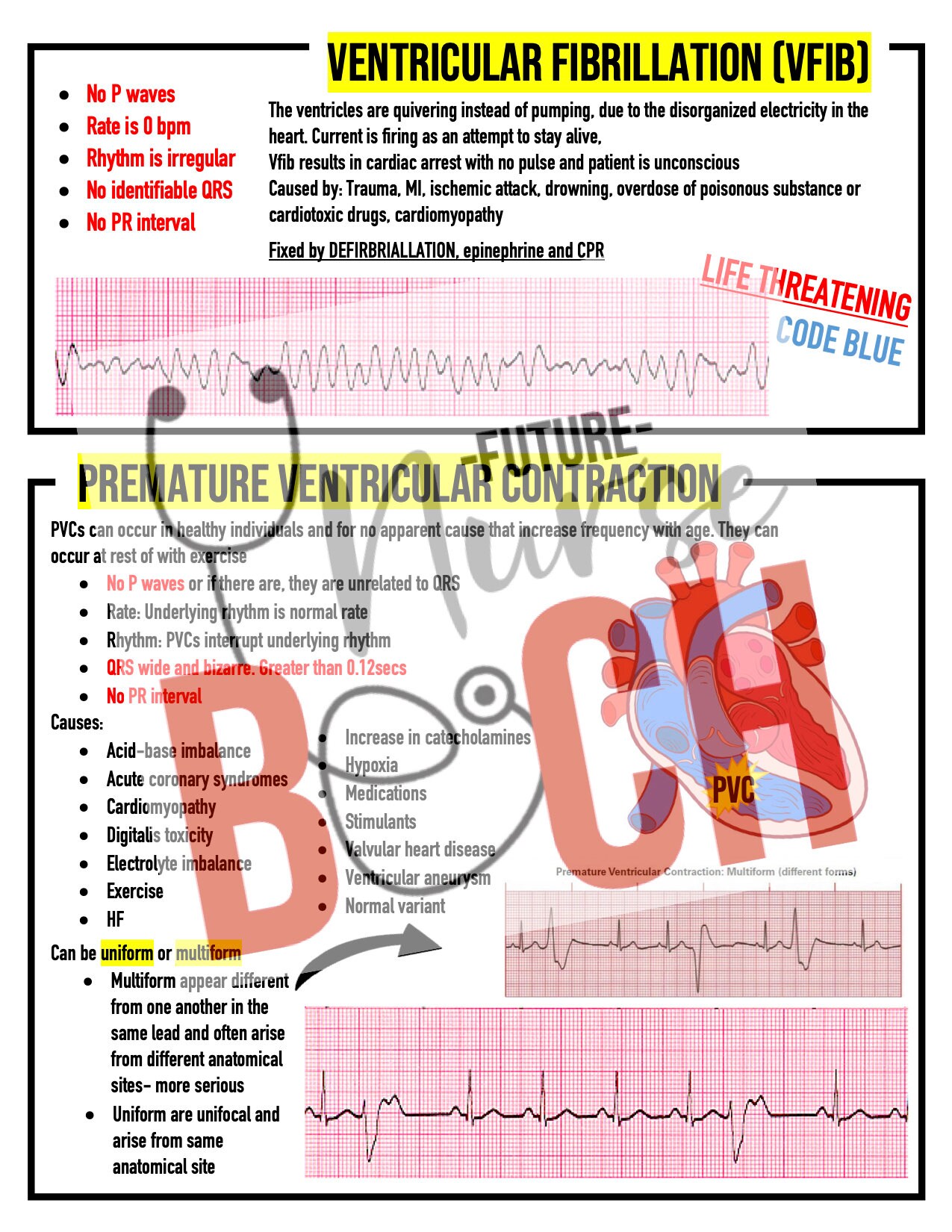 ECG and Rhythms Nursing School Notes - Etsy