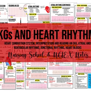 ECG and Rhythms Nursing School Notes