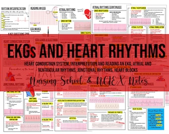 ECG and Rhythms Nursing School Notes