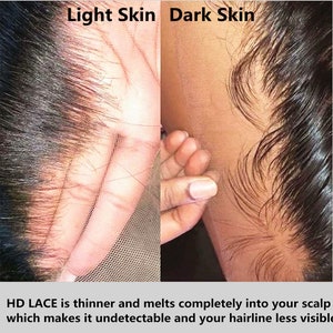 May include: Close-up of a lace wig showing how the lace melts into the skin of a light-skinned person and a dark-skinned person. The text reads "HD LACE is thinner and melts completely into your scalp which makes it undetectable and your hairline less visible."