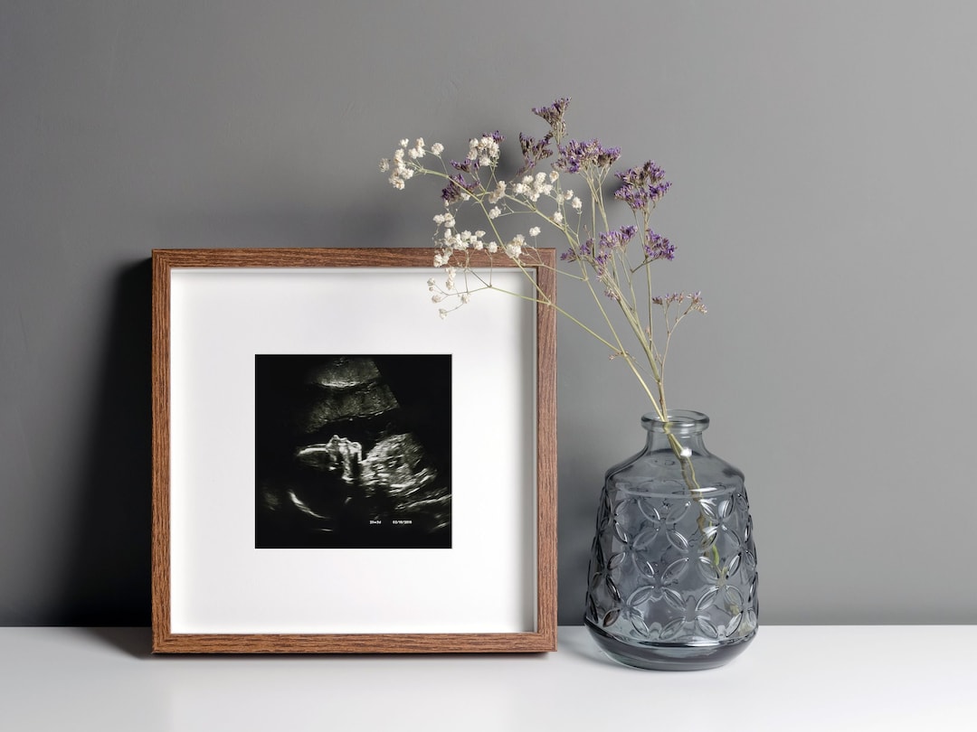 Baby Sonogram Print, Ultrasound Picture Display, Baby Keepsakes