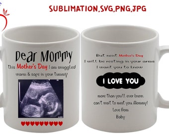 Download Ultrasound Baby Svg Etsy