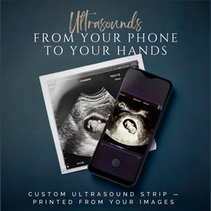 May include: A smartphone showing a grayscale ultrasound scan, placed near a printed ultrasound image. Text reads "Ultrasounds From Your Phone To Your Hands" and "Custom Ultrasound Strip - Printed From Your Images."