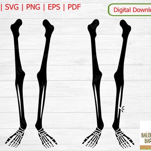 Broken Bones SVG, Skeleton Silhouette, Broken Bone, Fracture Bone, Broken Leg,  Broken Bone Clipart, Broken Femur, Digital Download