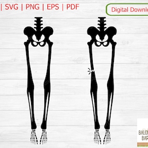 May include: Two black silhouette images of a human skeleton, one with both legs intact and the other with one leg broken at the knee.