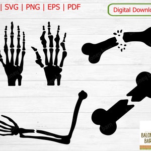Broken Bones SVG, Bones Silhouette, Skeleton Hands, Arthritis Hand, Fracture Bone, Broken Arm,  Broken Bone Clipart, Digital Download