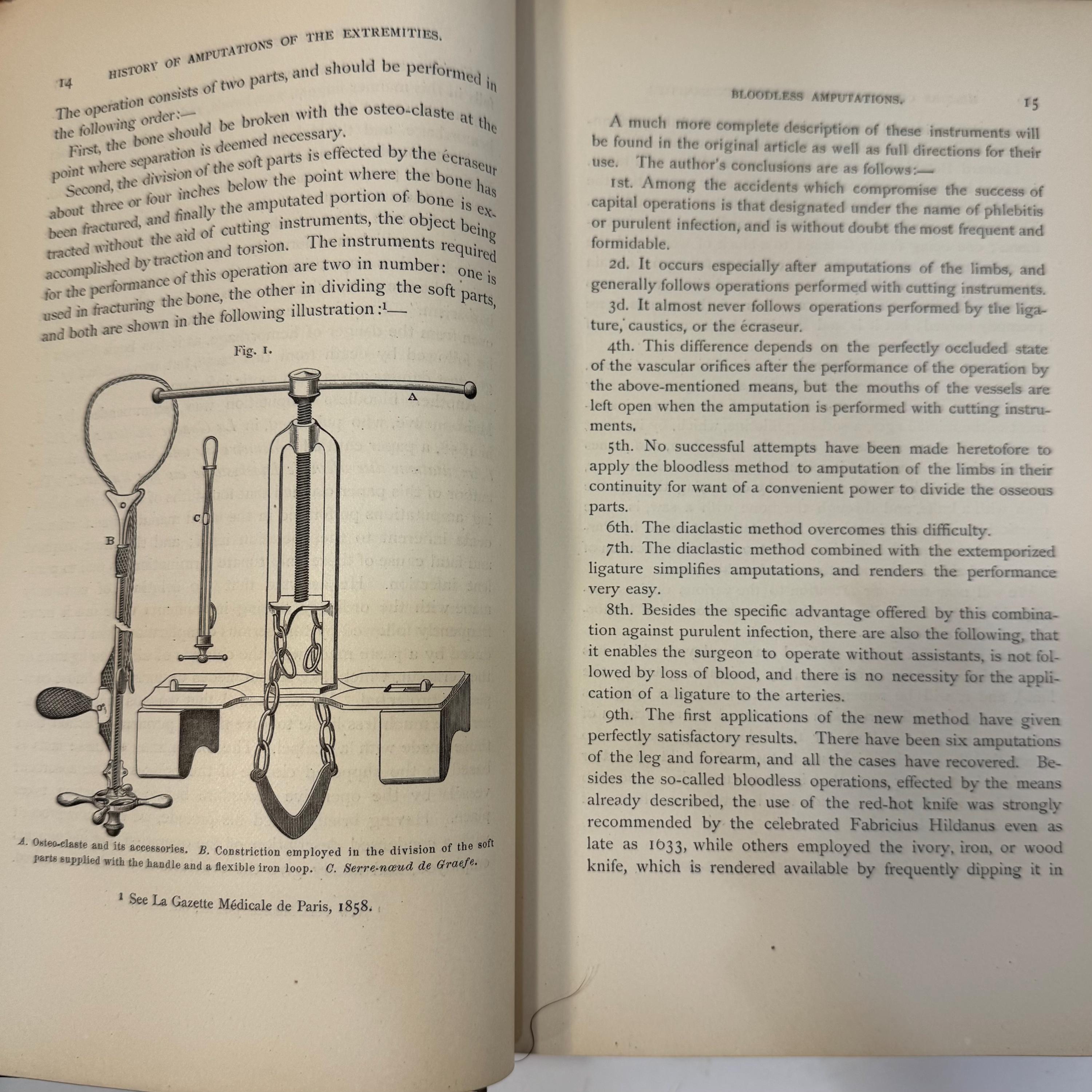 A Treatise on Amputations of The Extremities and Their Complications by Dr. B.A. Watson, 1885 | Illustrated with 250+ Images — photograph 10.