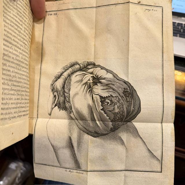 D. Io. Ern. Hebenstreit In Universitate Lipsensi Therapiae Prof. Publ. Facultatis Medicae Decani Vrbis Physici Anthropologia Forensis Sistens Medici Circa Rempublicam Causasque Dicendas Officivm Cum Rerum Anatomicarum ac Physicarum quae illud attinent expositionibus. Editio Altera C. Fig. Aeneis. Translated: Johann Ernst Hebenstreit, Public Professor of Therapeutics at the University of Leipzig, Dean of the Medical Faculty, and City Physician. Forensic Anthropology, Presenting The Duty of the Physician in Relation to the State And to Legal Cases, With Explanations of the Anatomical and Physical Matters That Pertain to It. Second Edition, With Copper Engravings. — photograph 4.