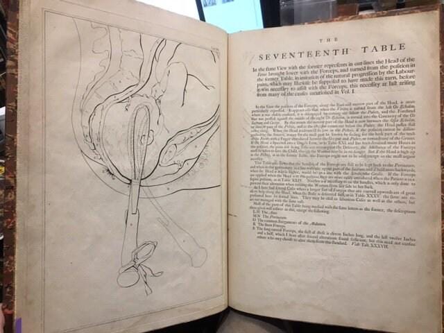 A Set of Anatomical Tables With Explanations of the Practice of ...