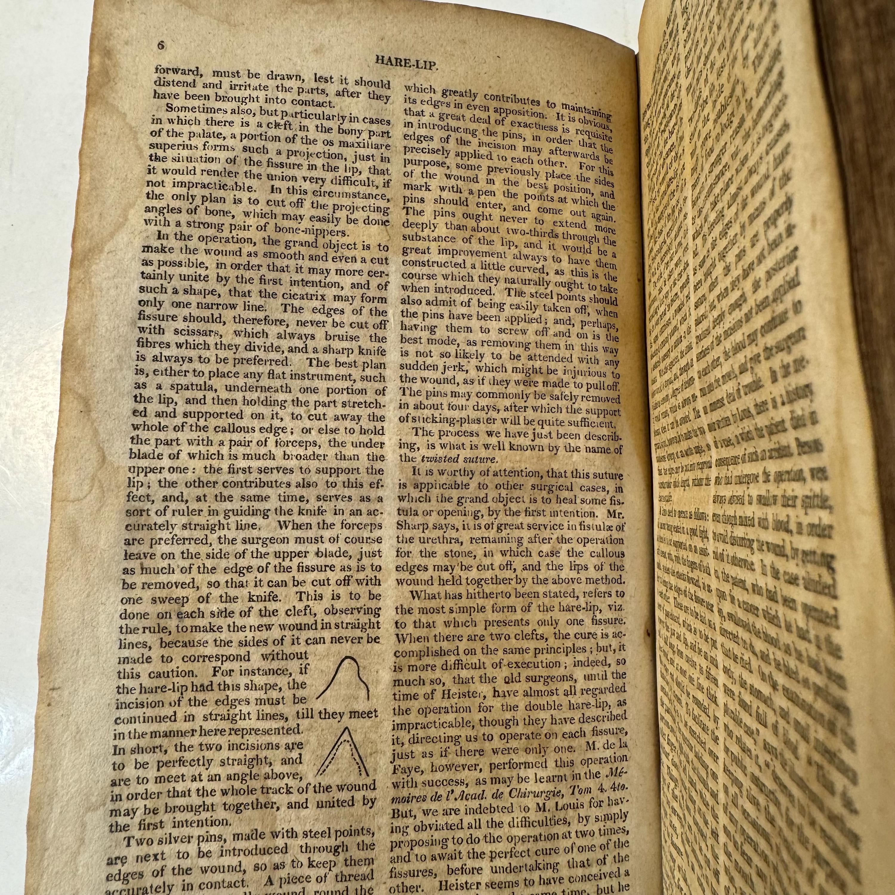 Dictionary of Practical Surgery, containing a complete exhibition of the present state of the principles and practice of Surgery, collected From the best and most original sources of information, and illustrated by critical remarks. — photograph 8.
