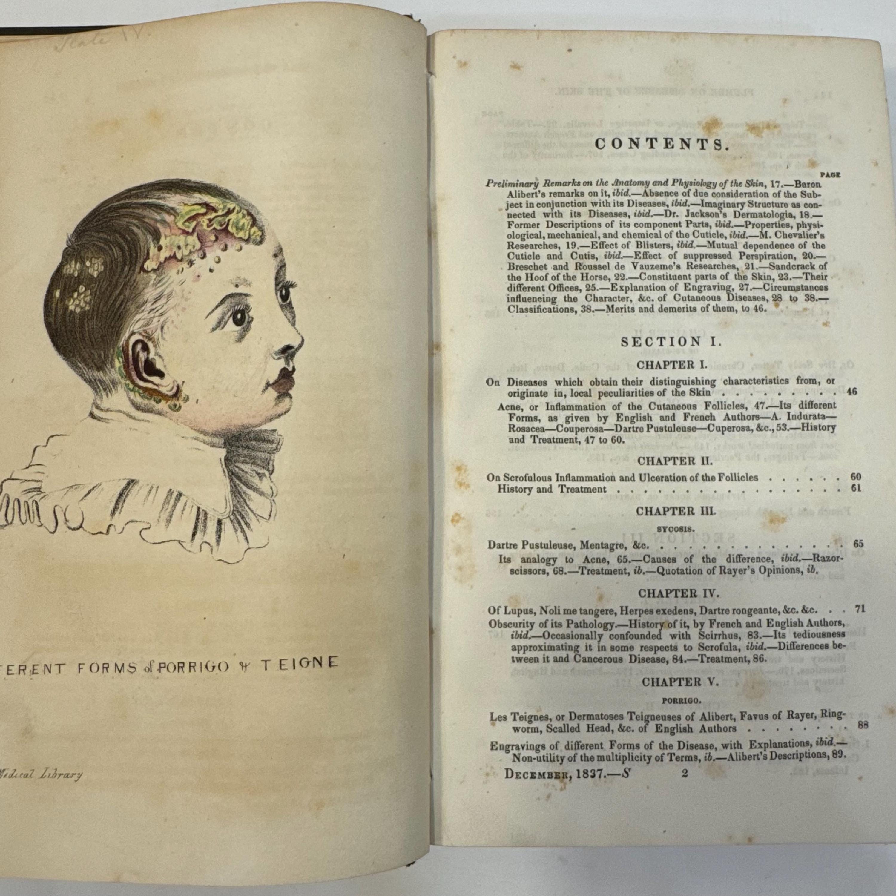 A Practical Treatise on The Diseases of The Skin by Samuel Plumbe, 1837 | Revised & Enlarged Edition — photograph 7.