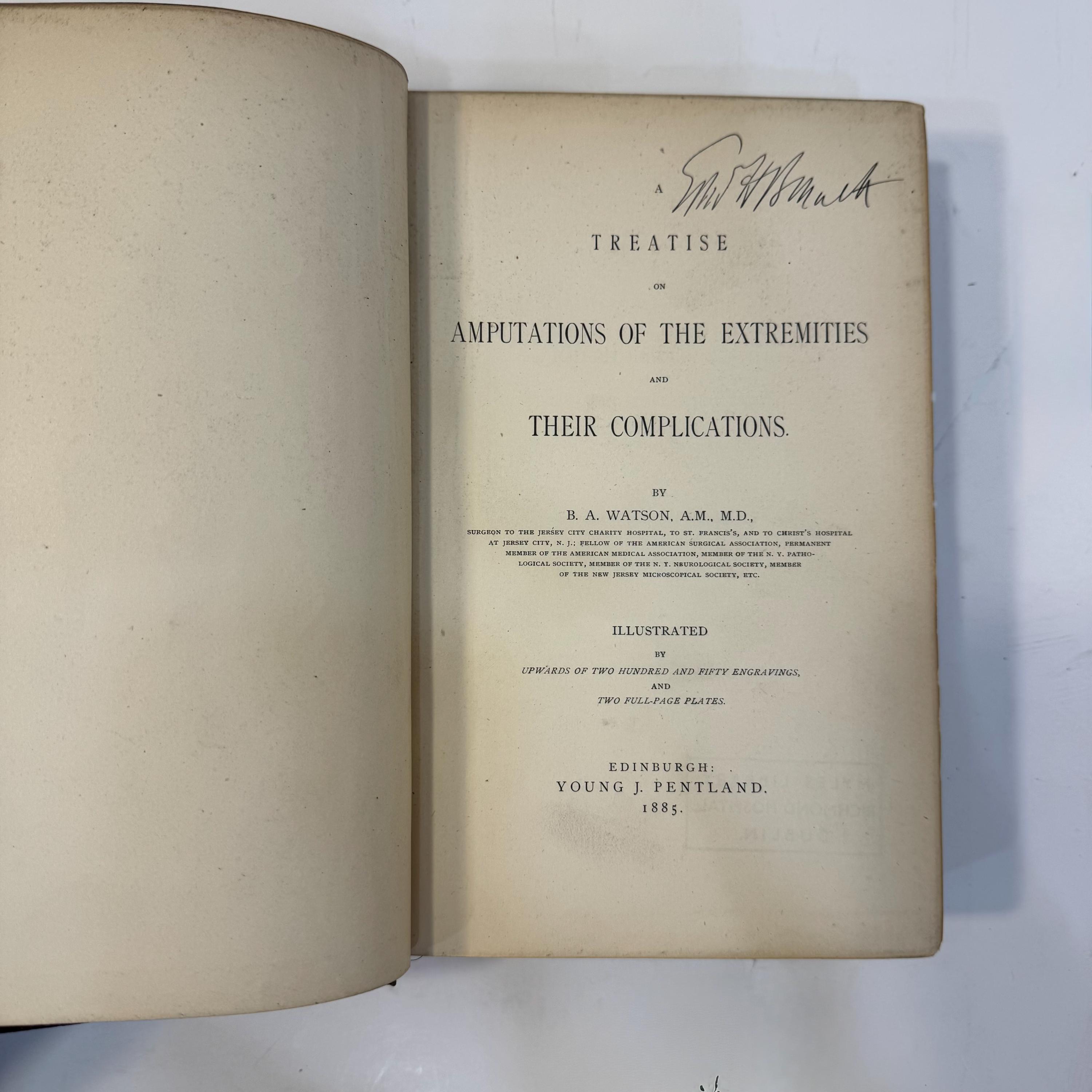 A Treatise on Amputations of The Extremities and Their Complications by Dr. B.A. Watson, 1885 | Illustrated with 250+ Images — photograph 7.