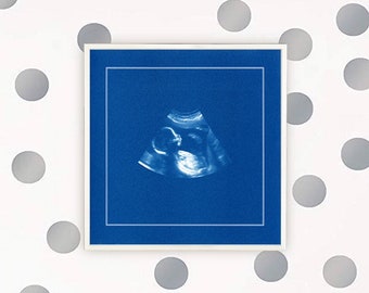 BABY ULTRASCHALL - maßgeschneiderte Sonogram - Cyanotypie - Unikat - Druck - Handarbeit - Blaupause - Spielzimmer - Kinderzimmer - Kinder - Geschenk