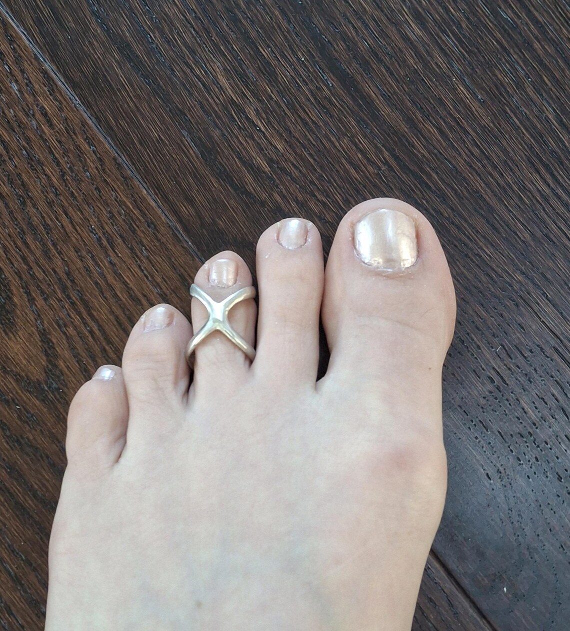 Toe Splint Adjustable, Sterling Silver 925 or Solid Bronze, Toe Ring - Etsy