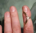 Adjustable Finger Ring Splint  bronze product logo