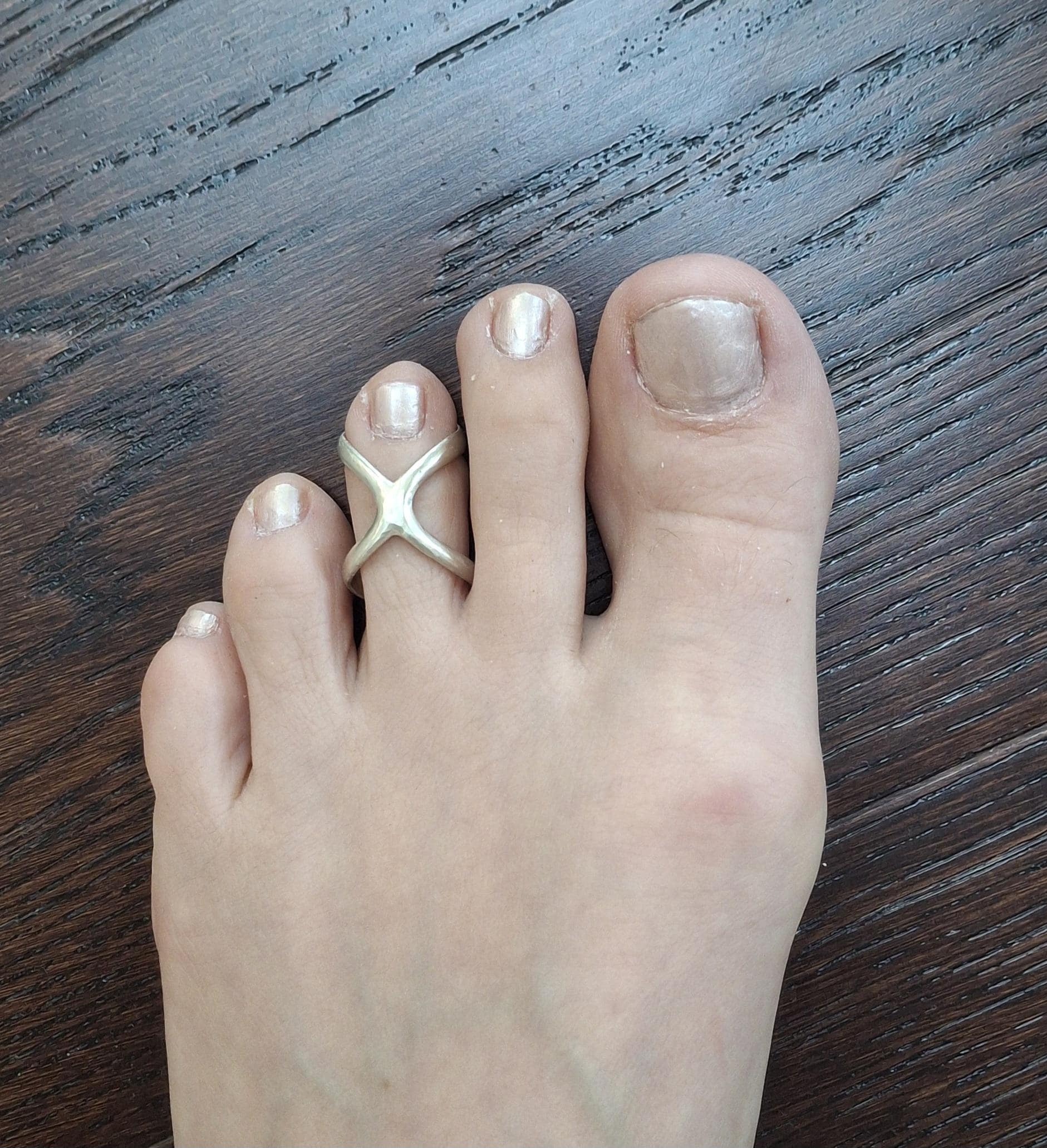 Arthritis toe splint EDS adjustable, sterling silver 925 or solid bronze, toe ring