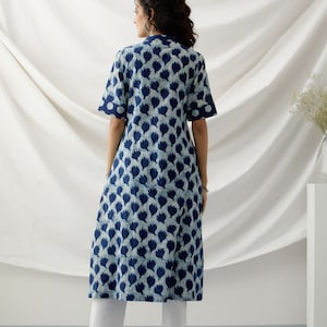 Block print tunic midi dress image 4