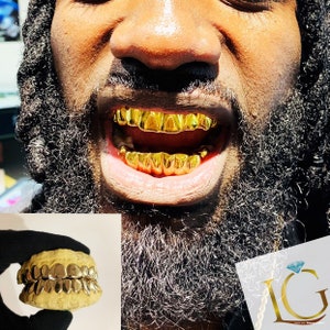 Custom Grillz 10pc on 10pc Solid Gold