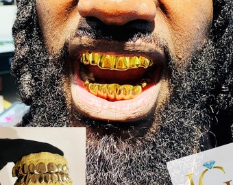 Custom Grillz 10pc on 10pc Solid Gold