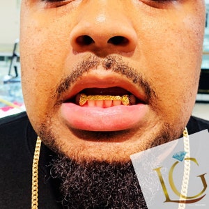 6 teeth with middle 4 bridge (Diamond cuts)