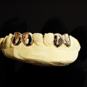 4 teeth (separate with bar included)