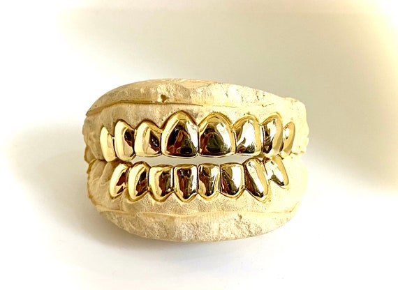 Custom Grillz 6pc Solid Gold with Permanent Cuts | Etsy