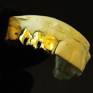 May include: Gold teeth grill with four gold teeth on a white mold. The grill is designed to fit over the front teeth.