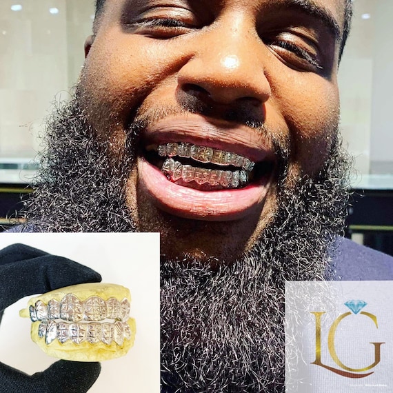 Starburst grillz shop