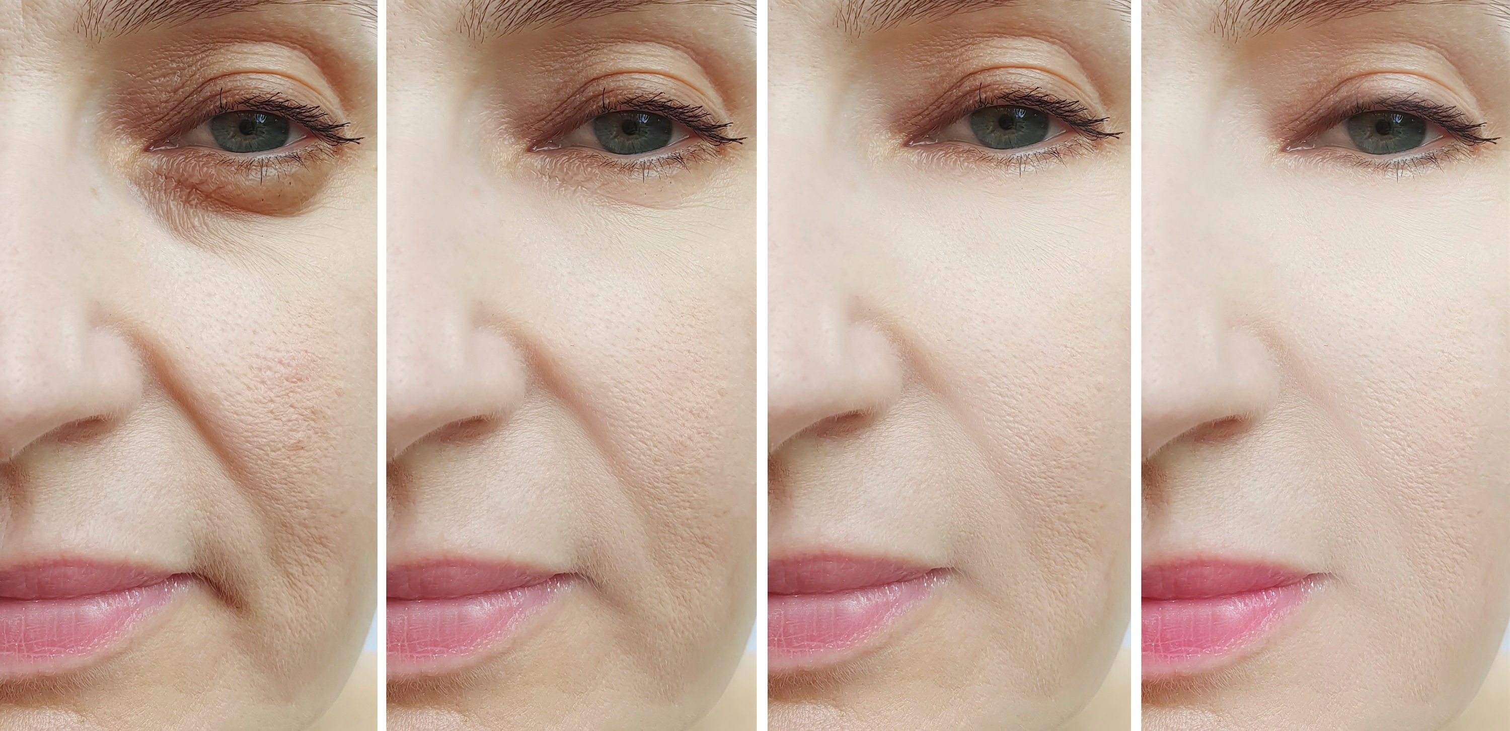 100 Hyaluronic Acid Super Hydrating Serum Dermatologist